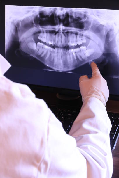 Best Emergency Dental Care for Broken or Chipped Teeth in Westwood, CA